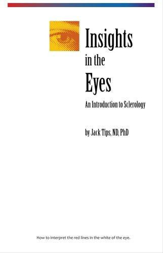 Discover the Wonders of Sclerology: Insights in the Eyes