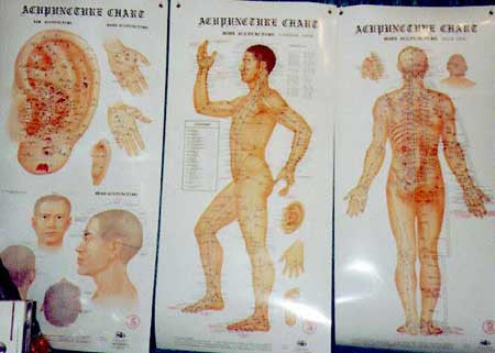 Amazing Acupressure Ear Chart (Auricular Points) Set